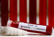 Koronavirus stigao u Sjenicu