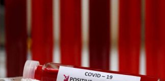 Koronavirus ne pogađa samo starije osobe, i mladi treba da budu oprezni