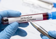 Prvi slučaj koronavirusa u beranskoj bolnici