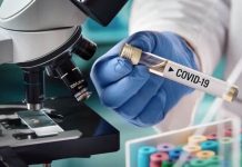 Još 4 nova slučaja zaraze koronavirusom u Crnoj Gori