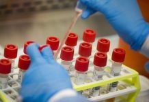 U Rožajama najviše novooboljelih u posljednje dvije sedmice