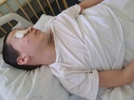 Opština Rožaje demantuje tvrdnje da su psi lutalice napali dijete u Rožajama