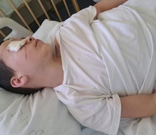 Uznemirujuće: Psi lutalice umalo rastrgli dijete u Rožajama